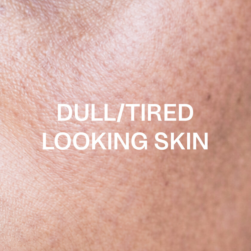 Trøtt eller gusten hud