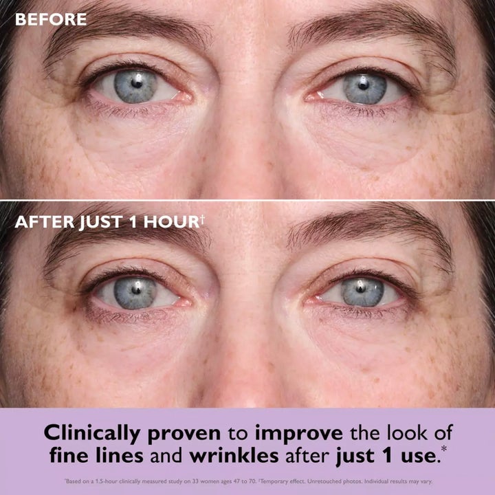 Peter Thomas Roth Instant FIRMx Collagen Infusion Eye Patches 8 stk viser før og etter resultat på fine linjer og rynker