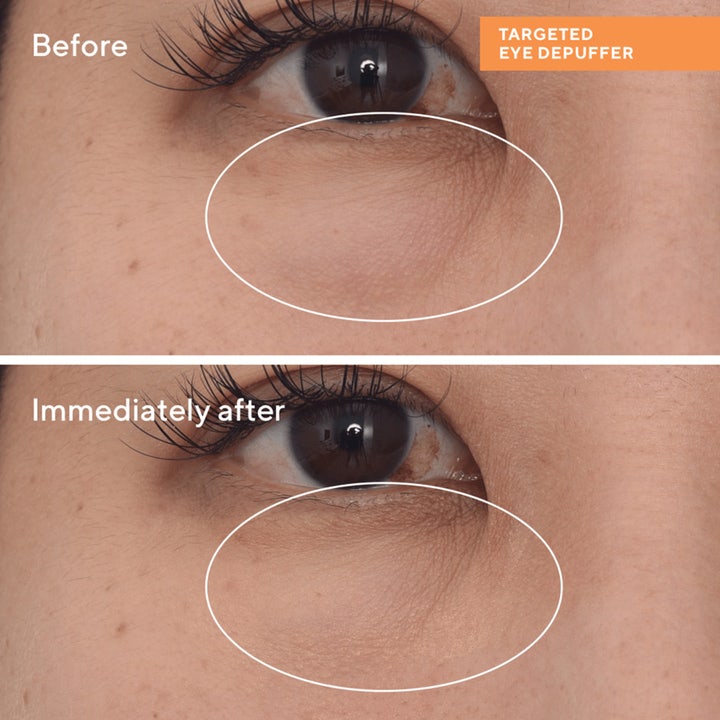 Murad Targeted Eye Depuffer 15 ml øyekrem før- og etterbilde som viser hvordan den demper hevelser under øyet.