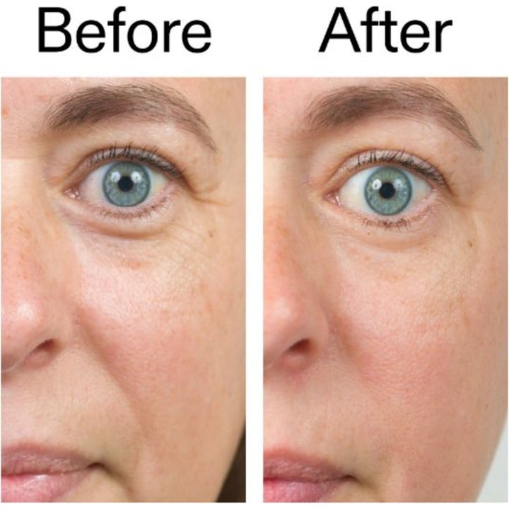 The INKEY List Bio-Active Ceramide Repairing and Plumping Moisturizer 50 ml før og etter resultat med glattere hud.