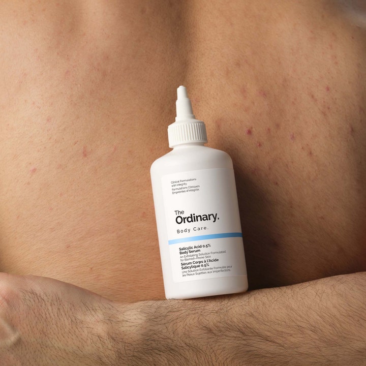 The Ordinary Salicylic Acid 0.5% Body Serum 240 ml eksfolierende kroppsserum i hvit flaske holdt mot en rygg med urenheter