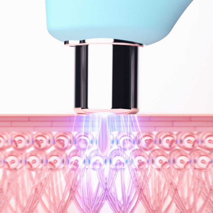 FOREO KIWI 1 stk pore-rensende beauty tech viser vakuumsug som fjerner urenheter fra hudlagene med lilla lys