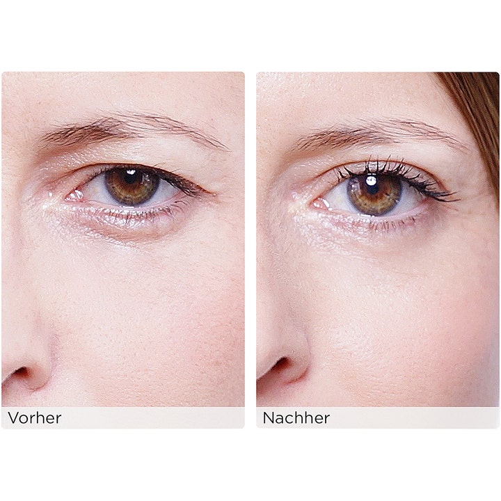 Wonderstripes The Instant Eye Lift Small 64 stk gir umiddelbart øyeløft vist med før og etter resultat.
