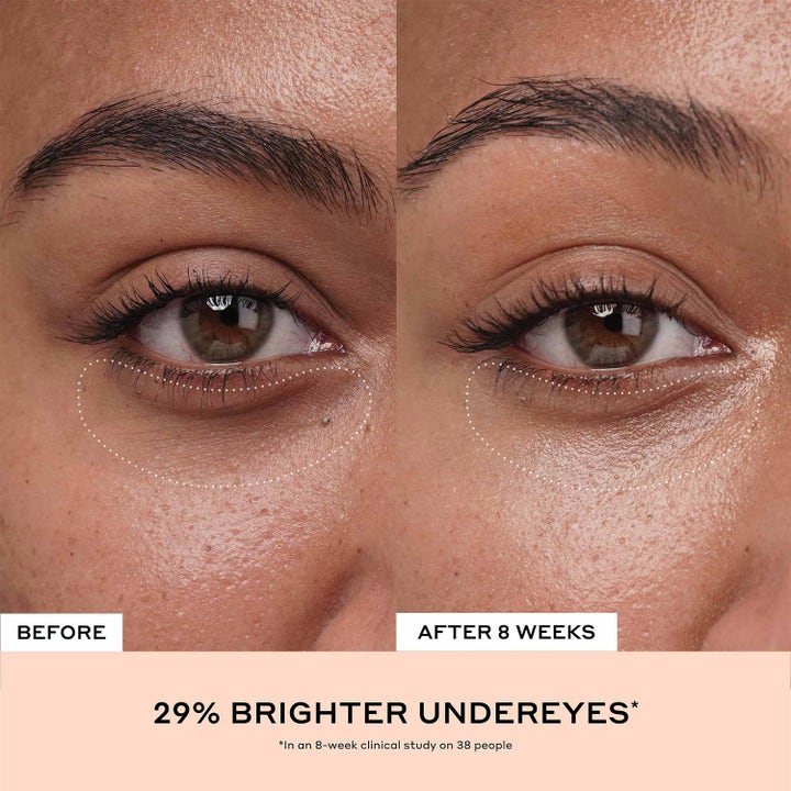 Ole Henriksen Truth Banana Bright + Eye Crème 15 ml vitamin C øyekrem viser før og etter resultat med lysere hud.