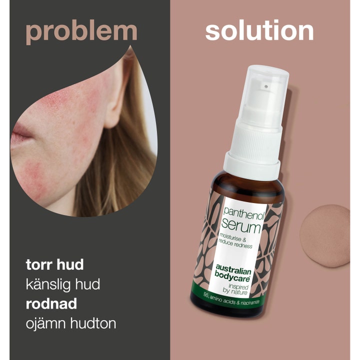 Australian Bodycare Panthenol Serum 30 ml ansiktsserum mot rødhet vist på brun glassflaske ved siden av irritert hud