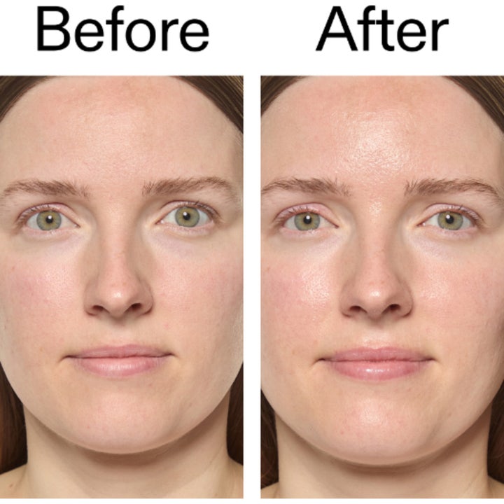The INKEY List Exosome Hydro-Glow Complex 30 ml serum før og etter som viser mer strålende og fuktet hud.