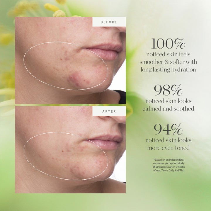 KORA Organics Active Algae Lightweight Moisturizer 15 ml dagkrem med før- og etterbilder som viser jevnere hudtone.
