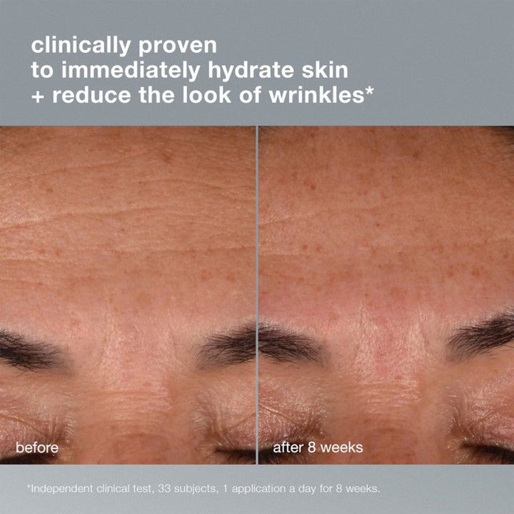 Dermalogica Dynamic Skin Recovery SPF50 100 ml dagkrem viser før og etter bilde med synlig færre rynker i pannen