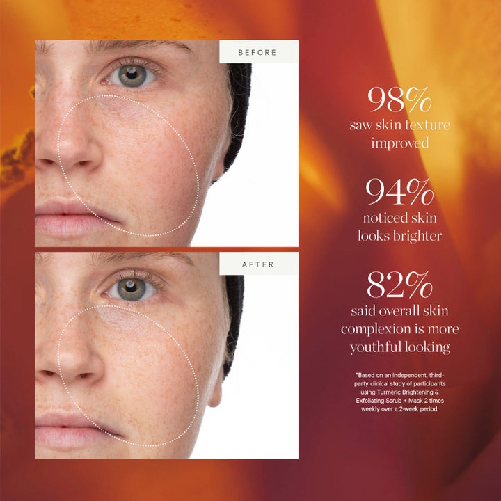KORA Organics Turmeric Brightening & Exfoliating Scrub & Mask 30 ml ansiktsskrubb før og etter bilder som gir lysere hud