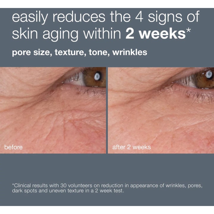 Dermalogica Dynamic Skin Retinol Serum 10 ml mot rynker viser synlig resultat på hudstruktur i før og etter bilde
