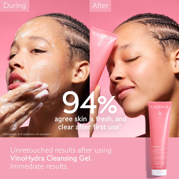 Caudalie Vinohydra Moisturizing Cleansing Gel 150 ml viser før og etter bruk på en kvinne med ren hud.