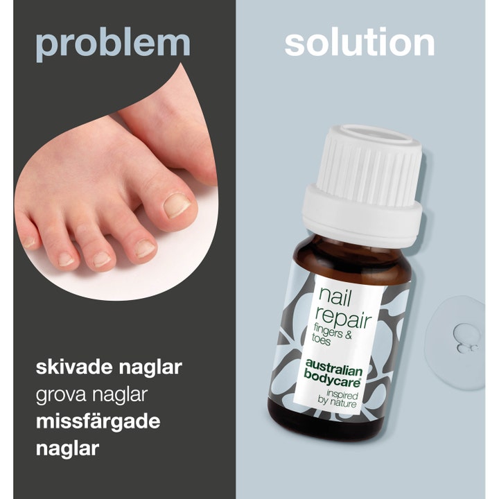 Nail Repair