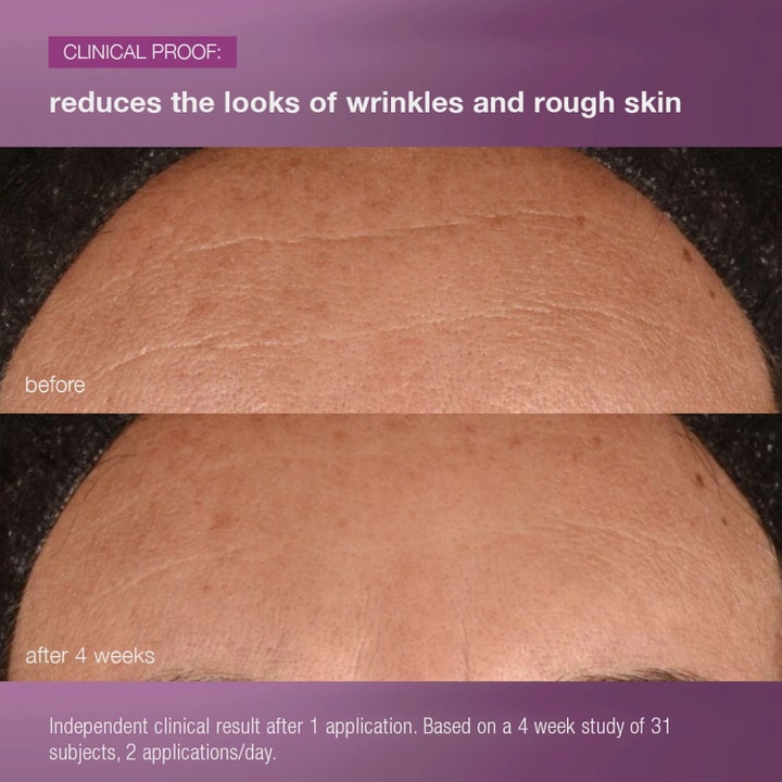 Dermalogica MultiVitamin Power Recovery Cream 50 ml nattkrem viser før og etter-bilder av reduserte rynker og glattere hud.