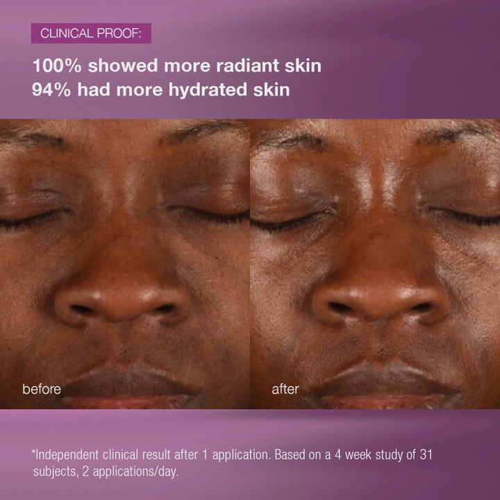 Dermalogica MultiVitamin Power Recovery Cream Duo før og etter bilder som gir mer glødende hud