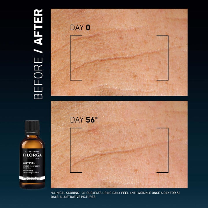 Filorga Daily Peel 50 ml anti-rynke peeling viser synlig hudforbedring på før- og etterbilder fra dag 0 til dag 56.