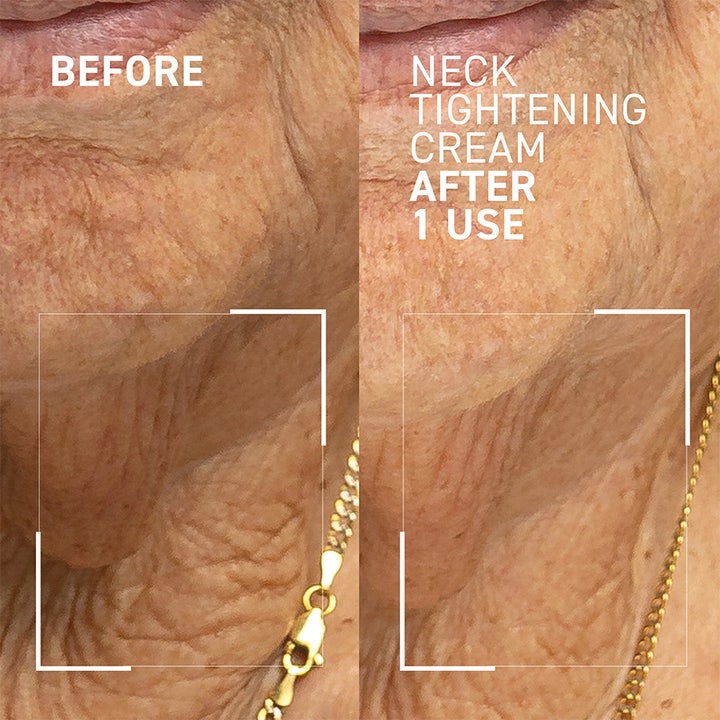 Dr Brandt Neck Tightening Cream 50 g oppstrammende halskrem som gir synlig før og etter resultat på rynker