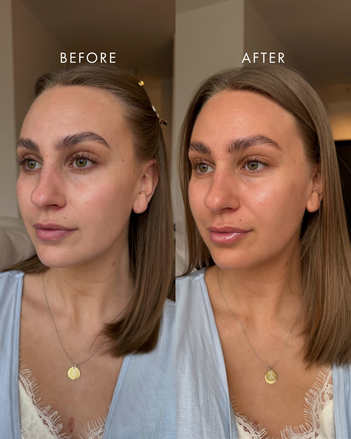 Hickap Sundazed Self Tanning Mist 100 ml selvbruning for ansiktet viser før og etter resultat med solkysset glød.