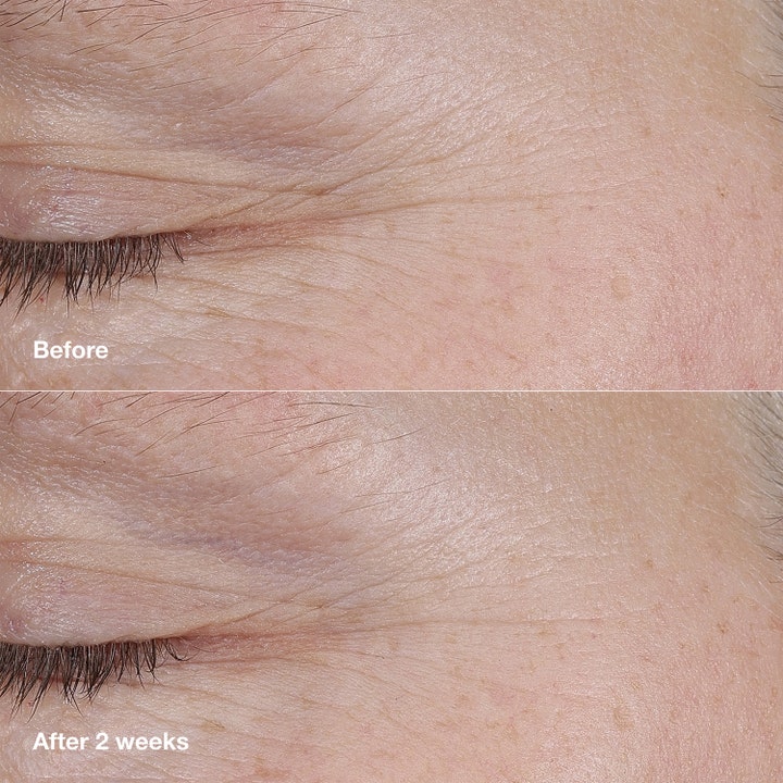 Clinique Smart Clinical Repair AM/PM Retinoid Balm 3 g mot rynker viser glattere hud i før og etter bilde over to uker.