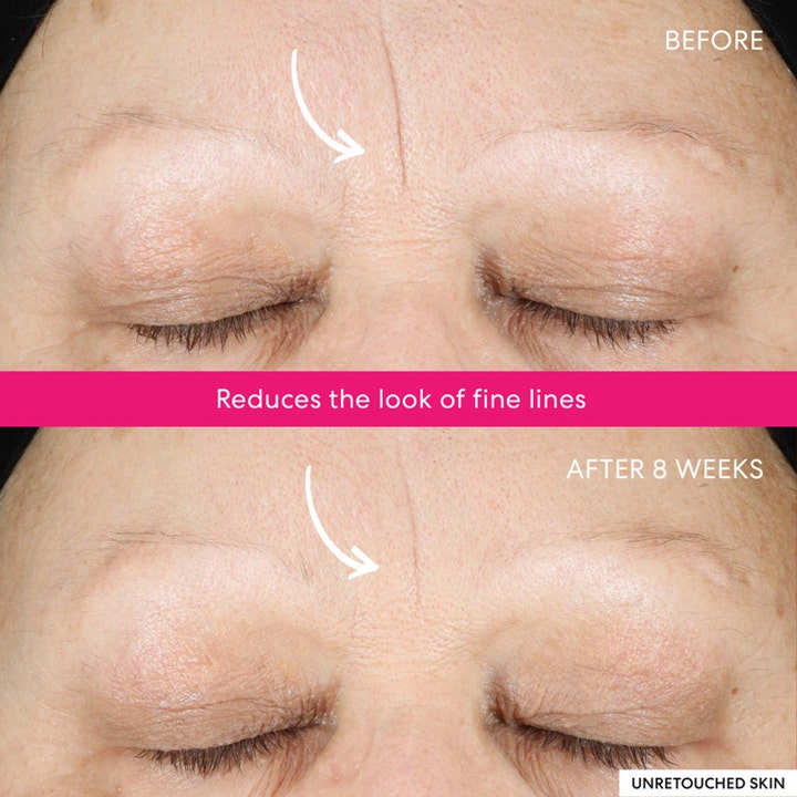 bareMinerals Ageless Phyto-AHA Radiance Facial 50 ml serum viser før og etter resultat på fine linjer etter 8 uker.