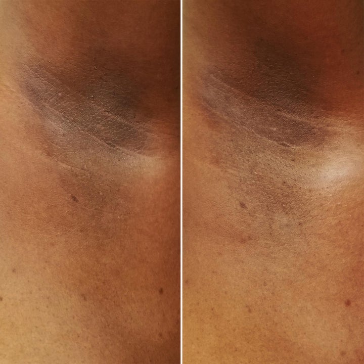 Sol de Janeiro Rio Deo 57 g aluminiumsfri deodorant som reduserer mørke partier i armhulen på mørkere hudtone