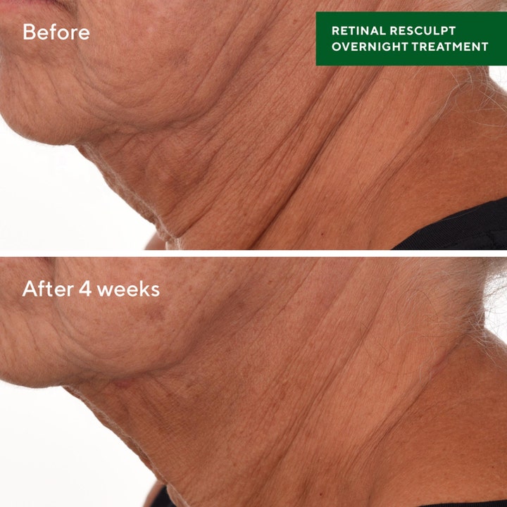 Murad Retinal ReSculpt Treatment 30 ml serum viser før og etter resultater på rynker på halsen etter fire uker.