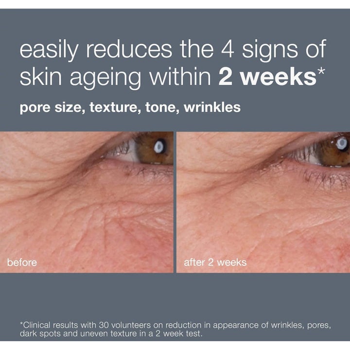 Dermalogica Retinol Renewal Duo 60 ml serum mot aldringstegn viser før og etter resultat på rynker og hudtekstur