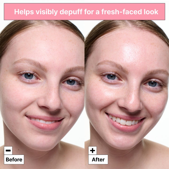 Dr.Jart+ Cryo Sorbet Icy Facial Mask 3 g ansiktsmaske viser før og etter resultat som demper hevelser for en frisk look