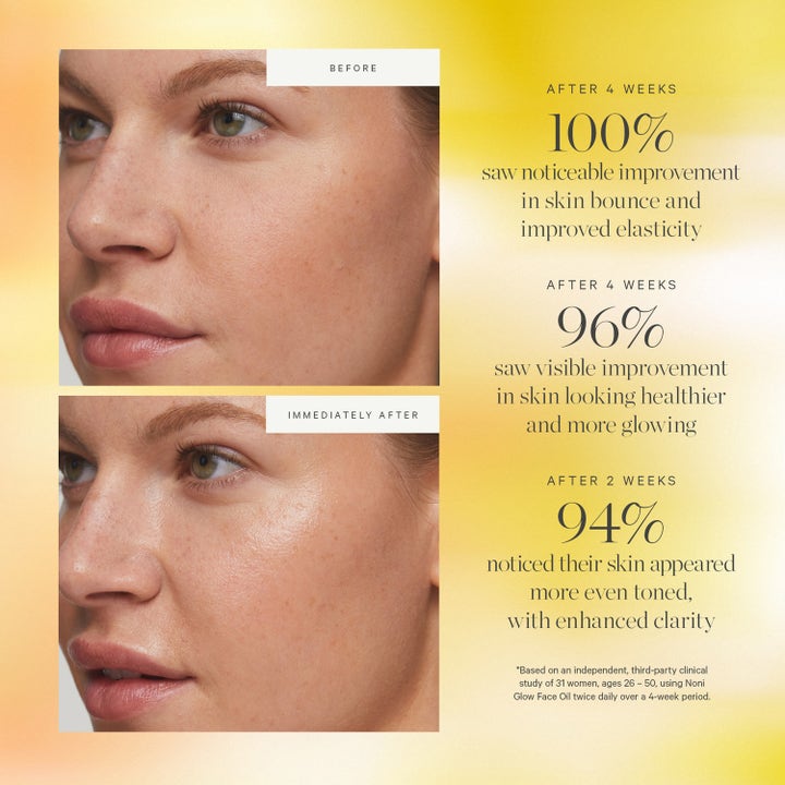 KORA Organics Noni Glow Face Oil 10 ml ansiktsolje før og etter bilder som viser glød og jevnere hudtone