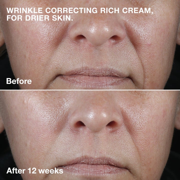 Clinique 3-Step Skincare System før og etter bilde som viser reduserte rynker etter 12 uker.