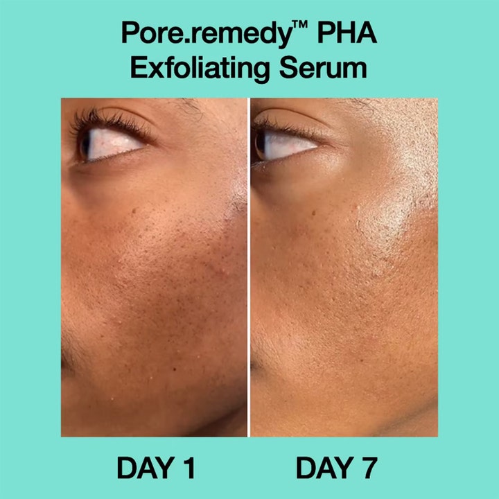 Dr.Jart+ Pore-remedy PHA Exfoliating Serum 30 ml viser synlig hudforbedring fra dag 1 til dag 7.