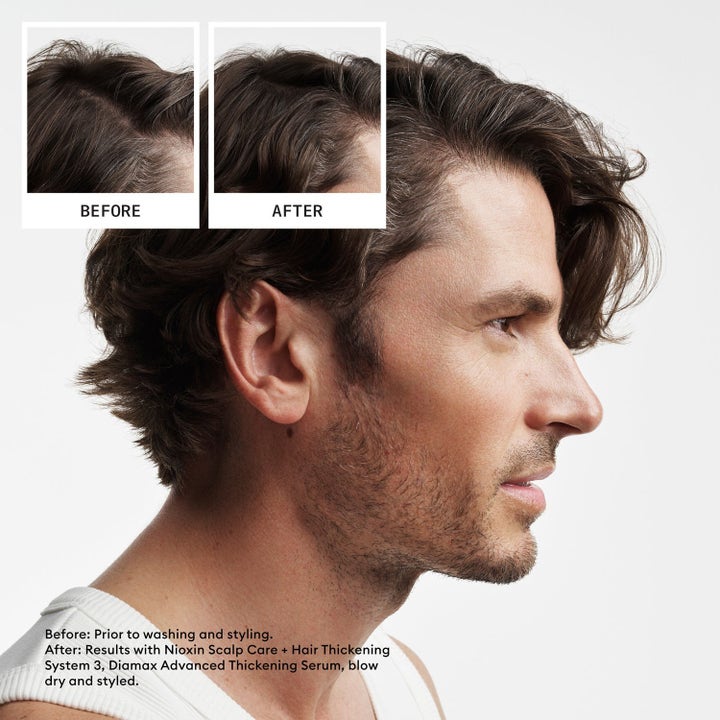 Hair Density Starter Set
