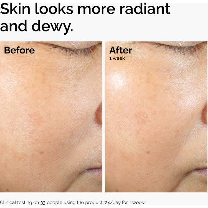 The Ordinary Rice Lipids + Ectoin Microemulsion 120 ml ansiktskrem gir mer glød i før og etter bilde.