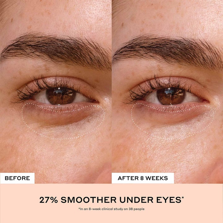 Ole Henriksen Truth Banana Bright + Eye Crème 15 ml øyekrem før og etter resultat viser glattere hud under øynene