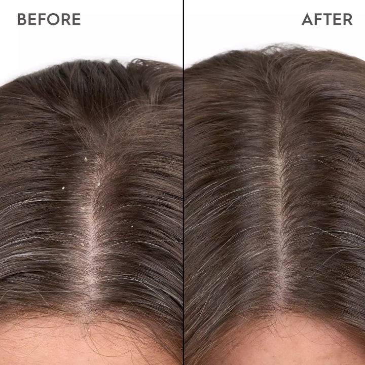 Anti-Dandruff Shampoo 250ml