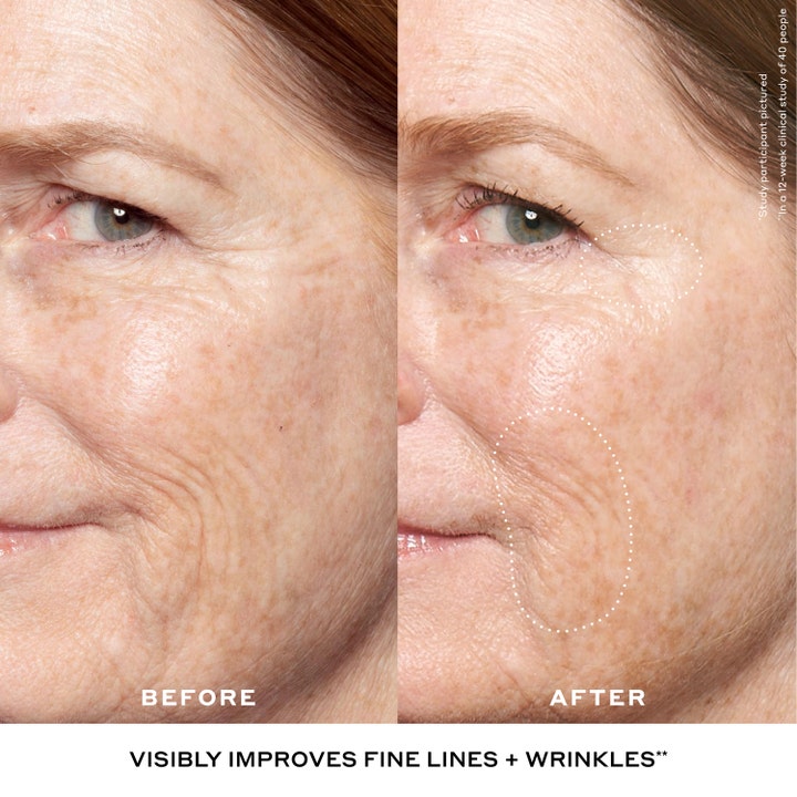 Ole Henriksen Double Rewind 0.3% Retinol Serum 30 ml før og etter bilde som viser færre rynker