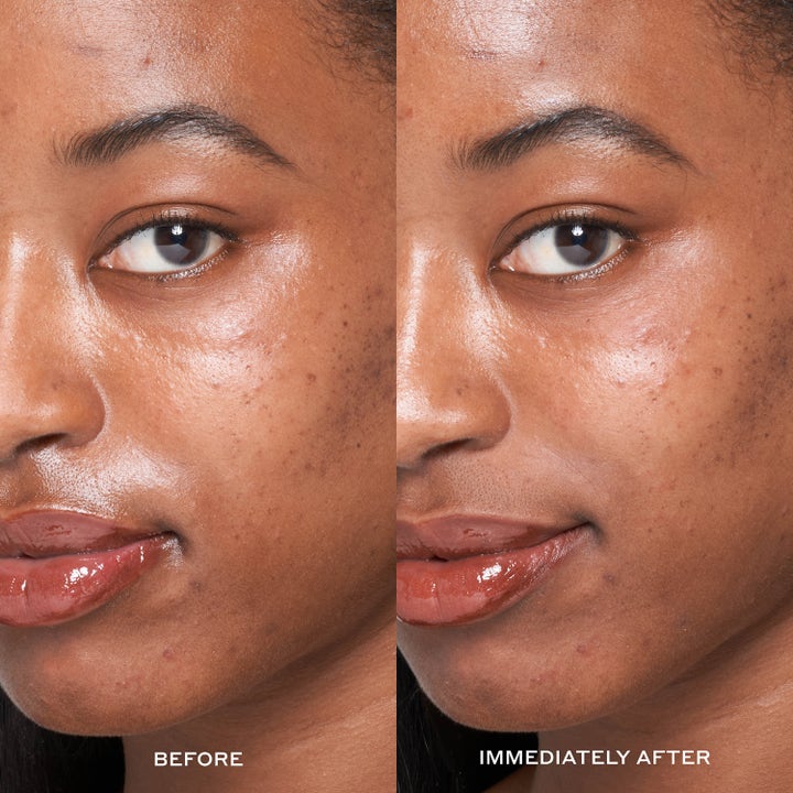 Ole Henriksen Transform Dewtopia 25% Acid Flash Facial 50 ml eksfolierer og gir umiddelbar glød vist på før og etter bilde
