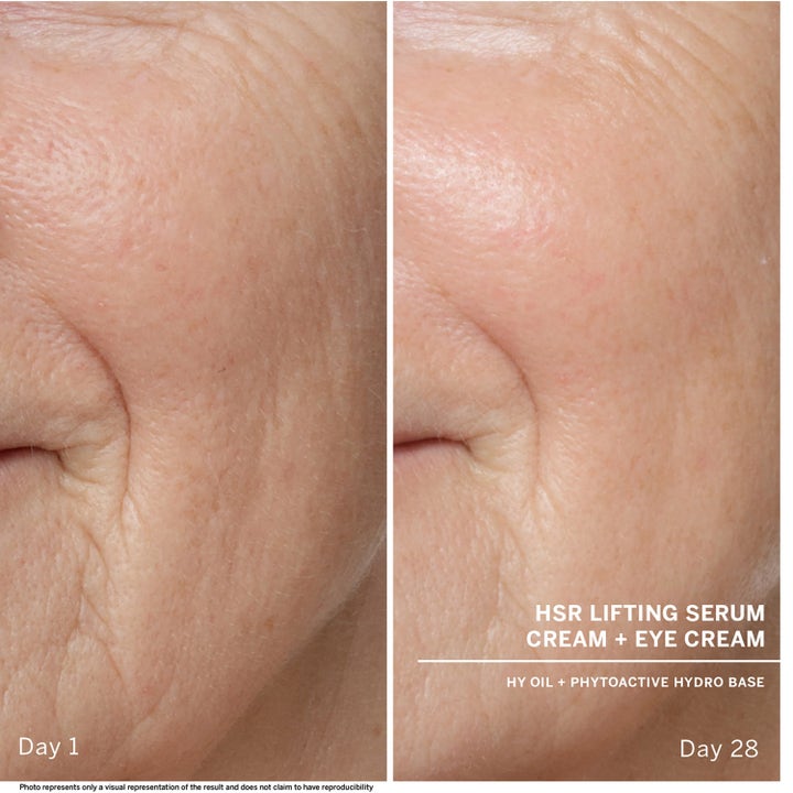Babor HSR Lifting Serum 30 ml oppstrammende serum viser hudens forbedring fra dag 1 til dag 28