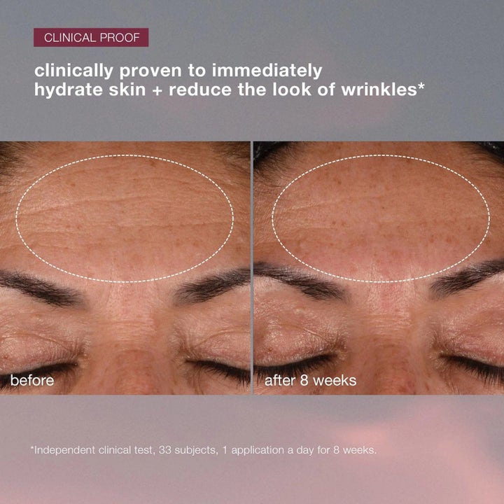 Dermalogica AGE smart Duo Dynamic Skin Recovery SPF50 ansiktspleie med før og etter bilde som viser reduserte rynker