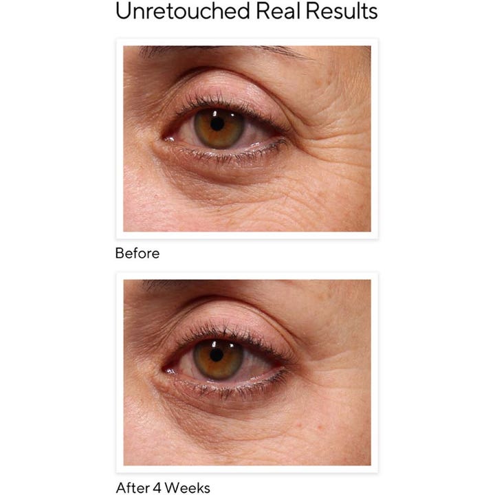 Murad Resurgence Retinol Youth Renewal Eye Serum 15 ml øyeserum viser før og etter resultater på rynker etter 4 uker.