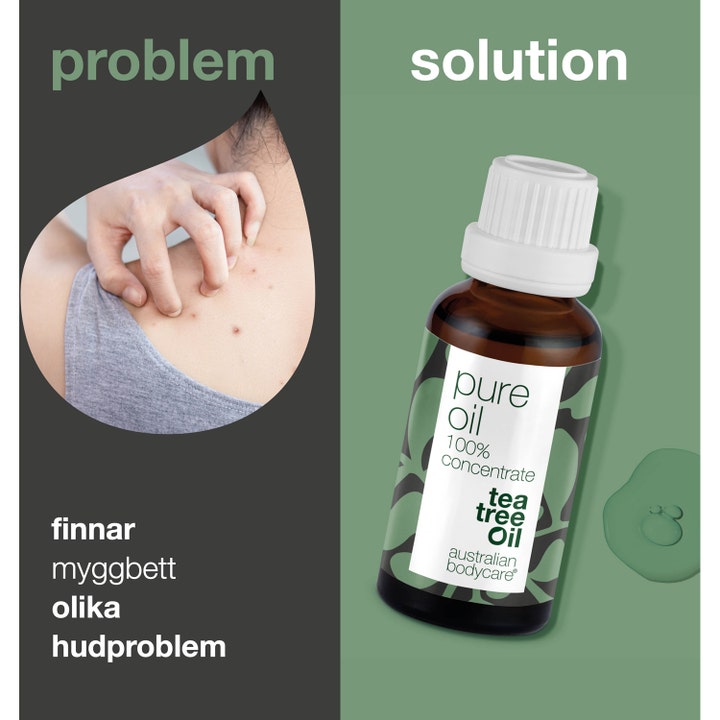 Australian Bodycare Pure Oil 30 ml mot kviser og hudproblemer vist med flaske og kløende rygg