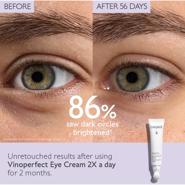 Caudalie Vinoperfect Brightening Eye Cream 15 ml øyekrem som lysner mørke ringer vist med før- og etterbilde
