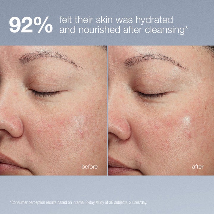 Dermalogica Magnetic Afterglow Cleanser Duo ansiktsrengjøring før og etter bilder som viser 92 prosent fuktet hud