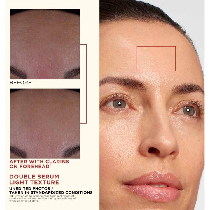 Clarins Double Serum Light Texture 50 ml ansiktsserum gir synlig glattere hud i pannen vist med før og etter-bilder.