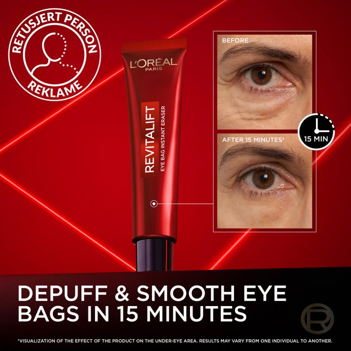 L'Oréal Paris Revitalift Laser Eye Bag Eraser 15 ml øyekrem viser før og etter resultat på poser under øynene.