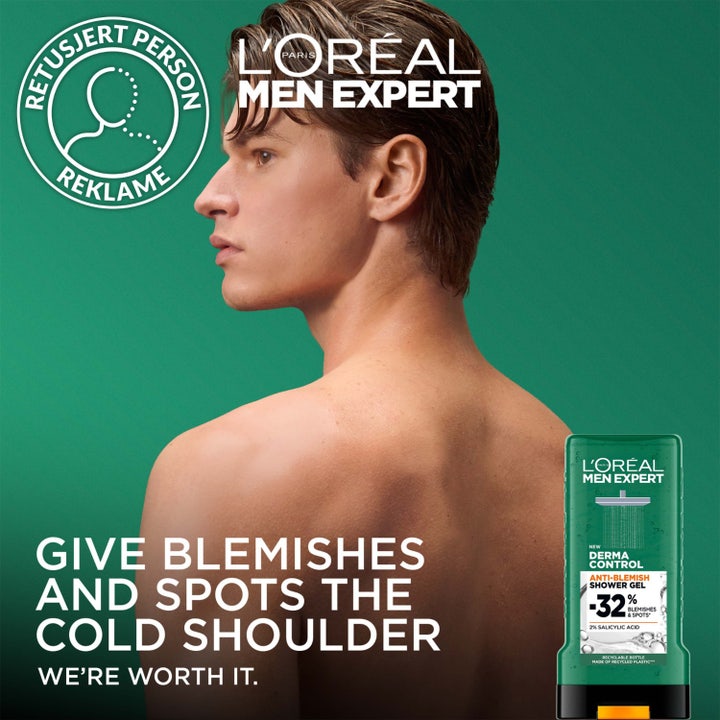 L'Oréal Paris Men Expert Derma Control 300 ml dusjsåpe mot urenheter viser en mann sett bakfra mot grønn bakgrunn.
