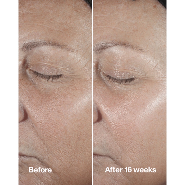 Clinique Smart Clinical Repair Wrinkle Correcting Serum 30 ml reduserer rynker vist i før og etter 16 uker resultat.