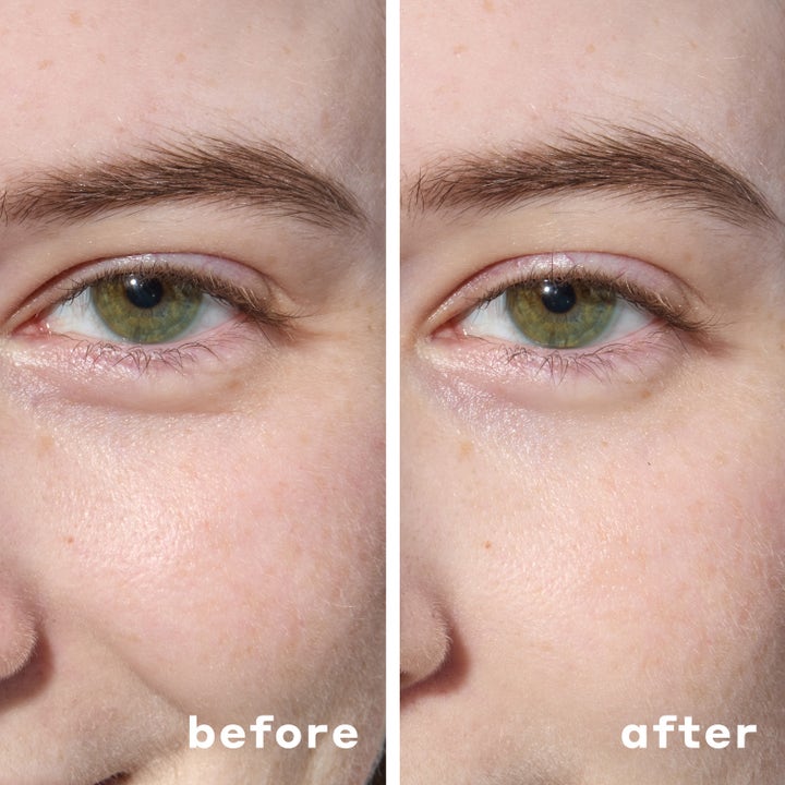 Hydrogel Under Eye Mask