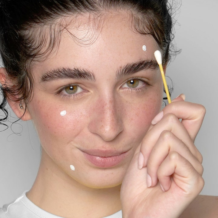 Niche Beauty Lab Acnemy Dryzit 30 ml spot treatment som fjerner kviser med hvit krem påført med en bomullspinne