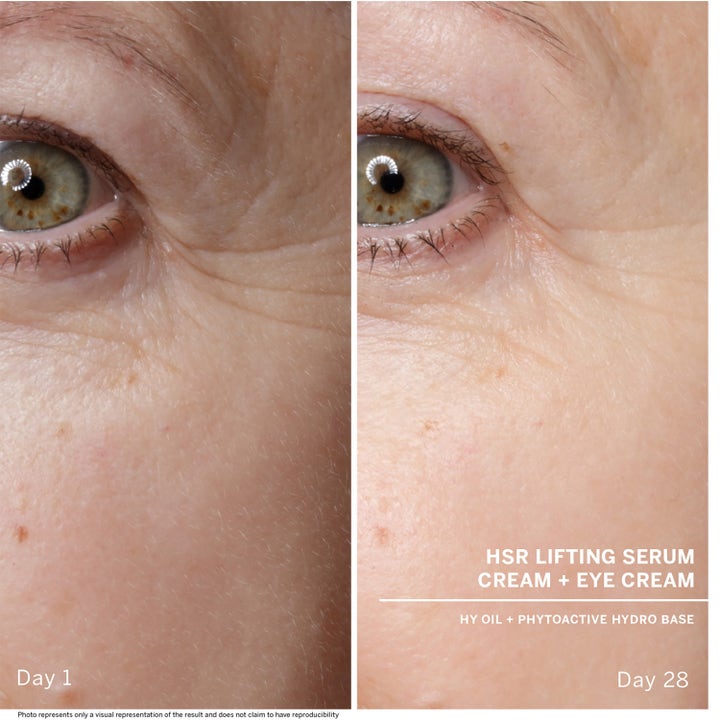 Babor HSR Lifting Serum 30 ml viser synlig reduksjon av rynker ved øyet fra dag 1 til dag 28.