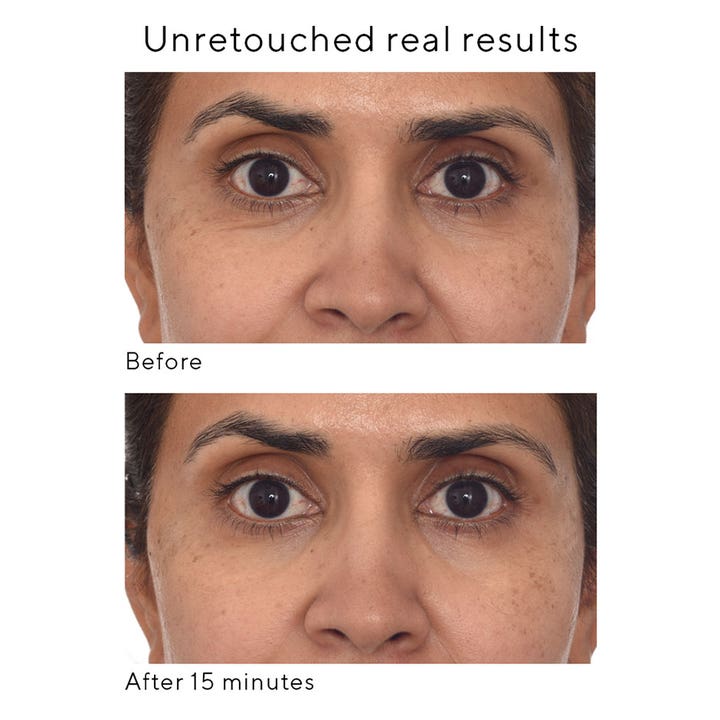 Murad Retinol Youth Renewal Eye Mask 5 stk øyemasker viser før og etter resultater med glattere hud etter 15 minutter